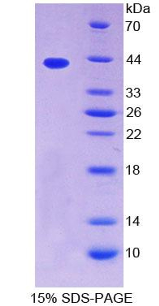 Human Recombinant Tropomyosin 2 Beta (TPM2)