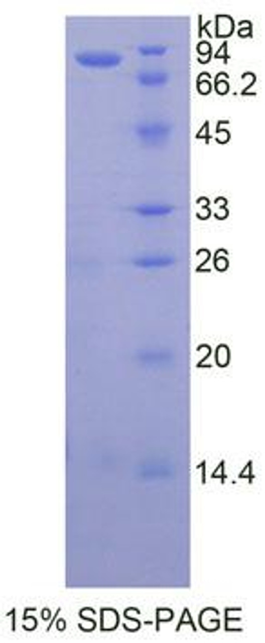 Human Recombinant Heat Shock Protein 90kDa Alpha B1 (HSP90aB1)