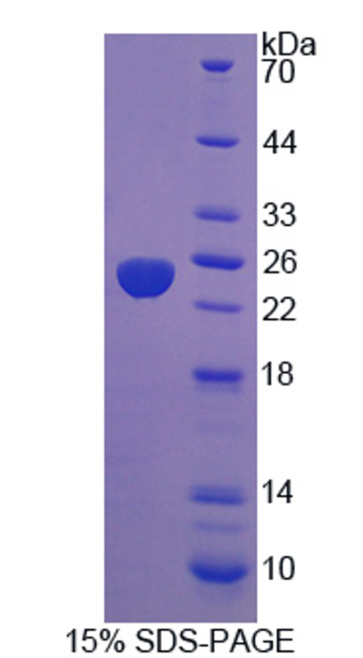 Human Recombinant Protein Tyrosine Phosphatase Type IVA 3 (PTP4A3)