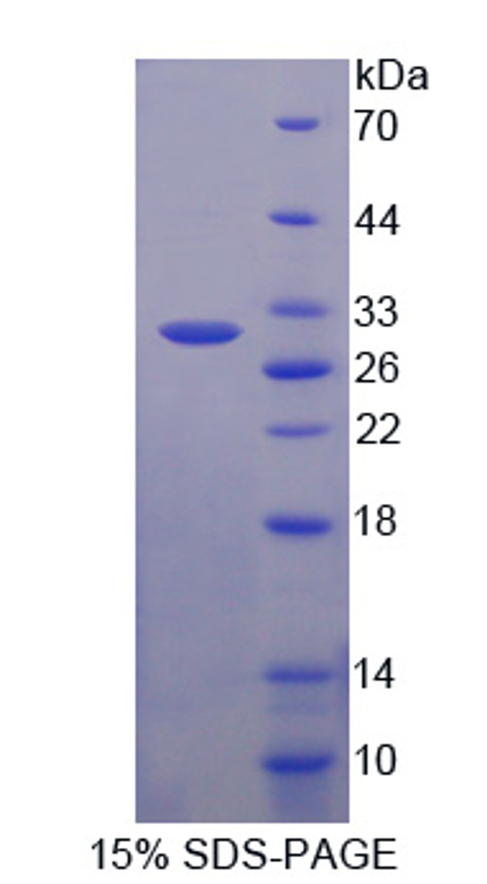 Human Recombinant ATP Binding Cassette TransPorter C3 (ABCC3)