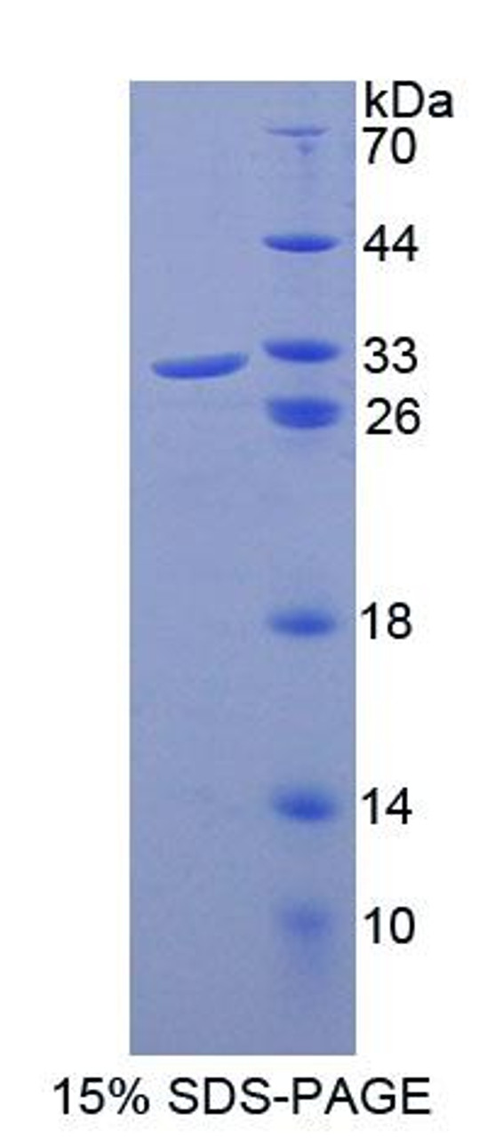 Mouse Recombinant ATP Binding Cassette Transporter B8 (ABCB8)