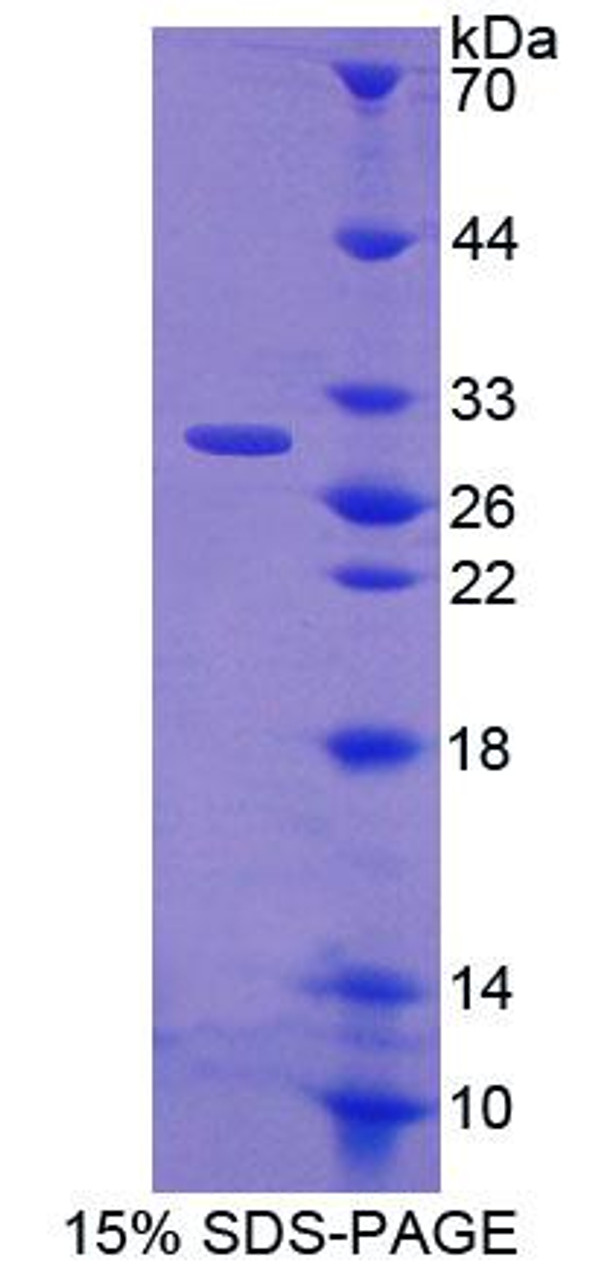 Human Recombinant ATP Binding Cassette Transporter F2 (ABCF2)