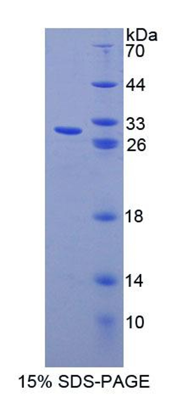 Mouse Recombinant ATP Binding Cassette Transporter F1 (ABCF1)