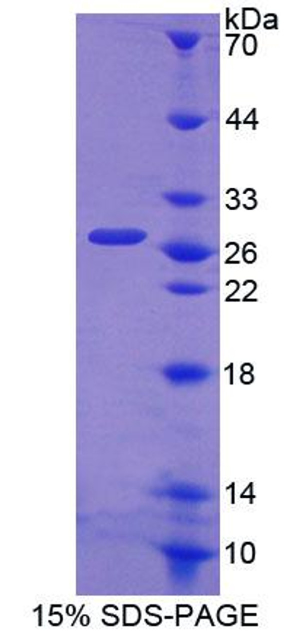 Mouse Recombinant ATP Binding Cassette Transporter A6 (ABCA6)