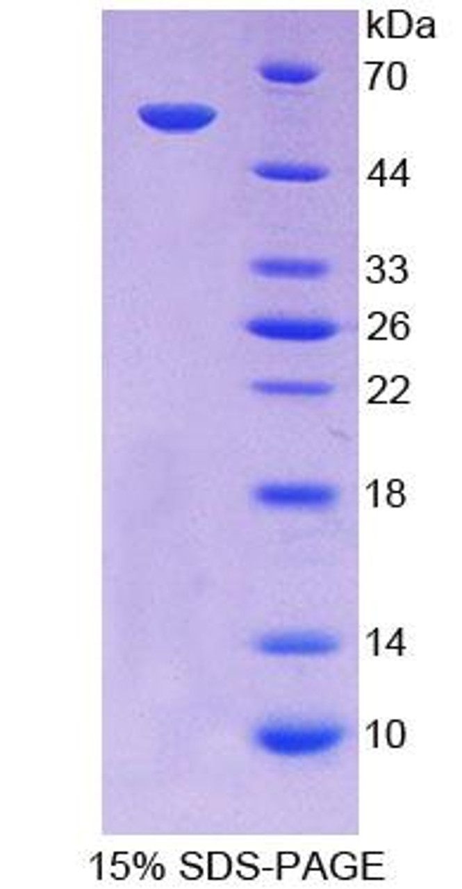 Mouse Recombinant ATP Binding Cassette TransPorter A13 (ABCA13)