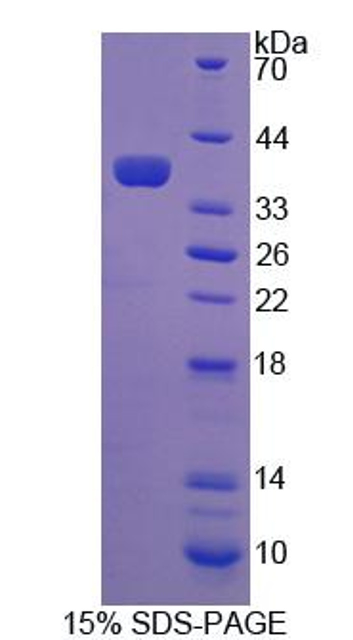 Human Recombinant Coenzyme A Synthase (COASY)