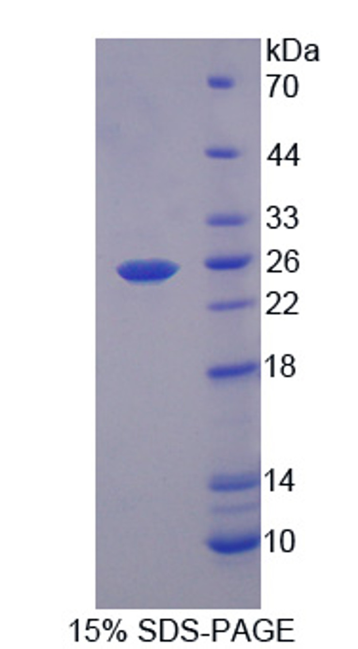 Mouse Recombinant Regulator Of G Protein Signaling 5 (RGS5)