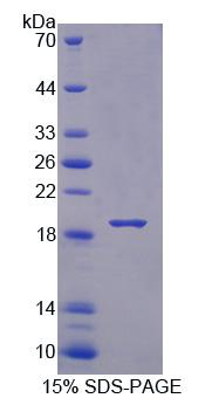 Mouse Recombinant Bisphosphoglycerate Mutase (BPGM)