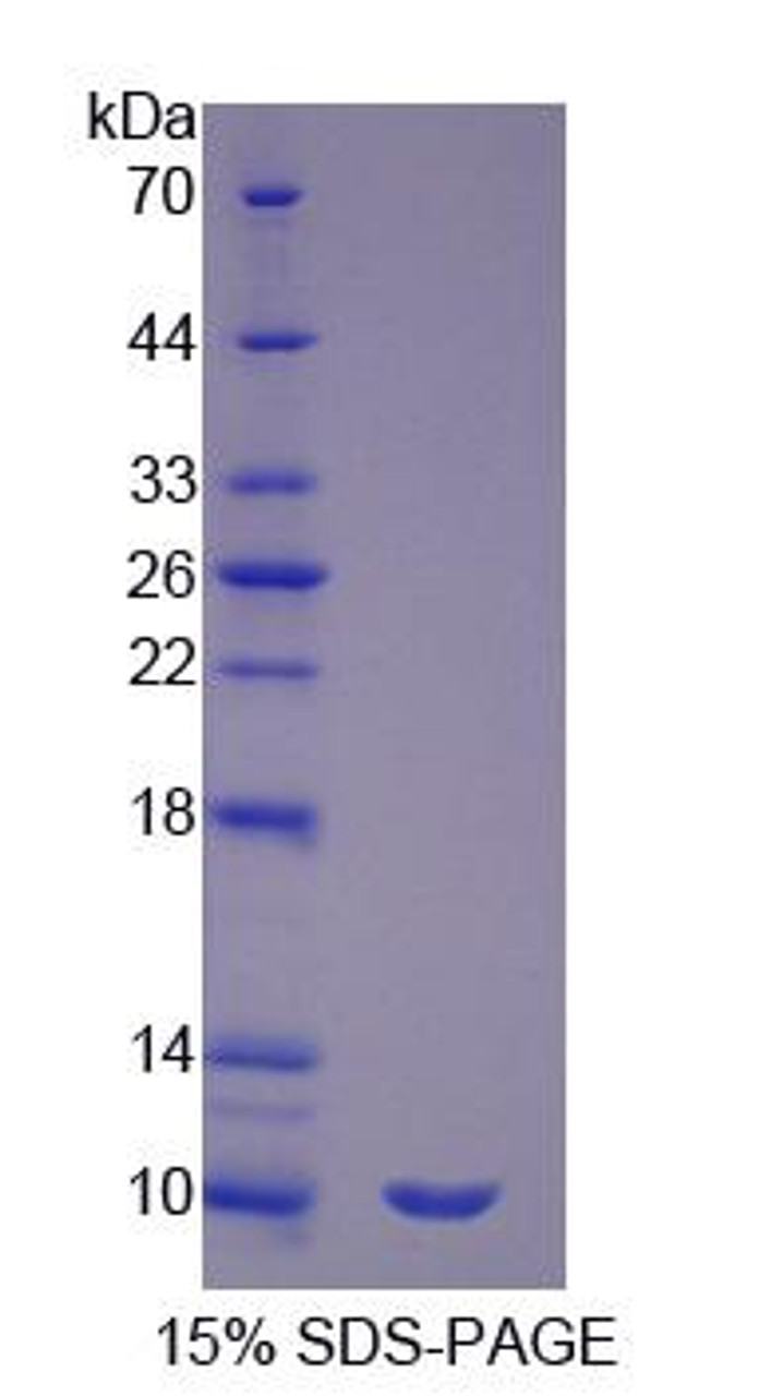 Human Recombinant Surfactant Associated Protein G (SPG)