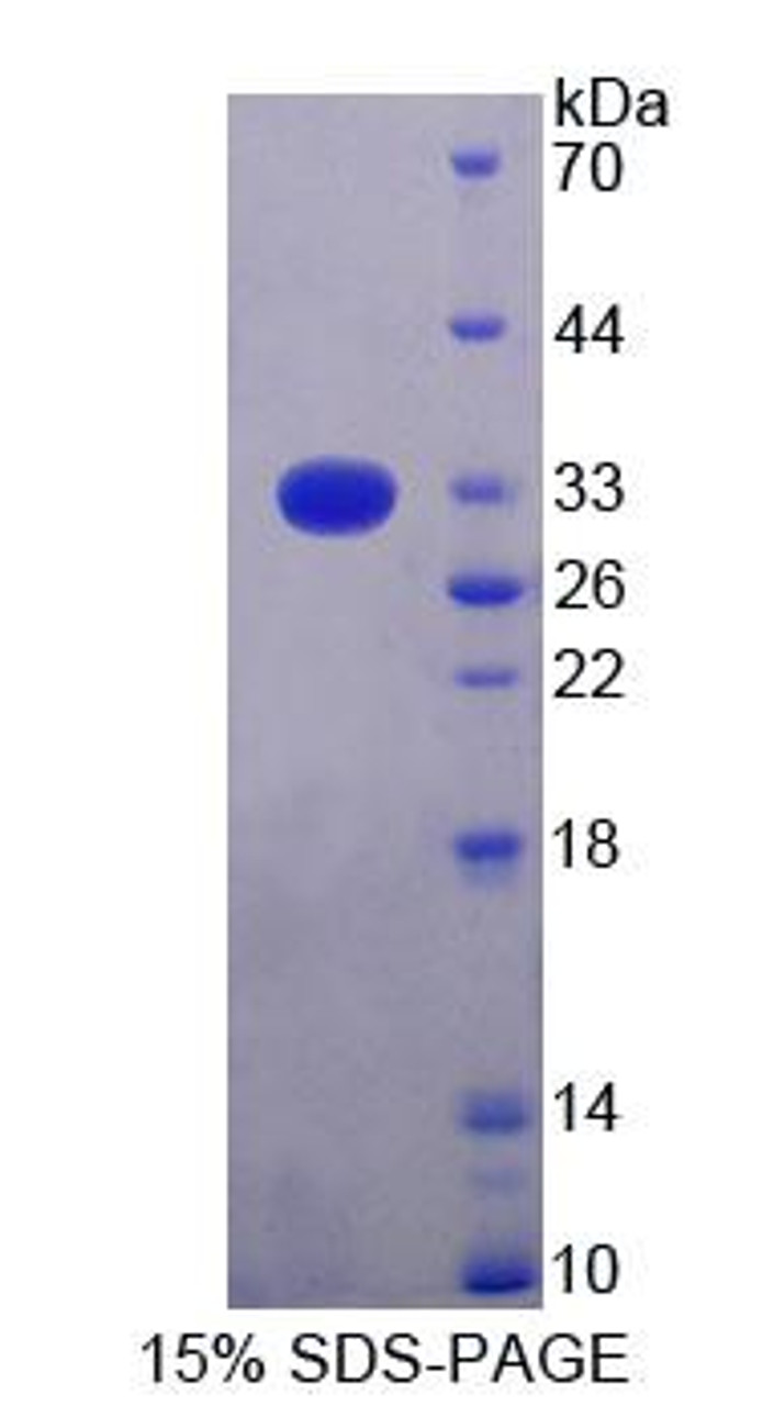 Rat Recombinant Topoisomerase I, Mitochondrial (TOP1MT)