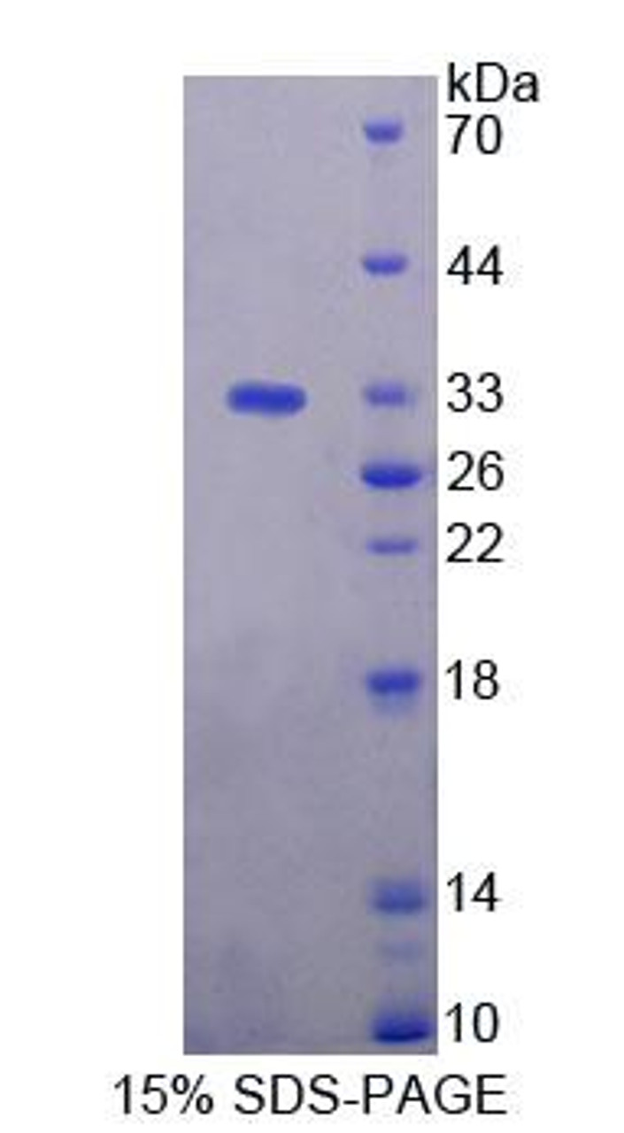 Human Recombinant Topoisomerase II Binding Protein 1 (TOPBP1)