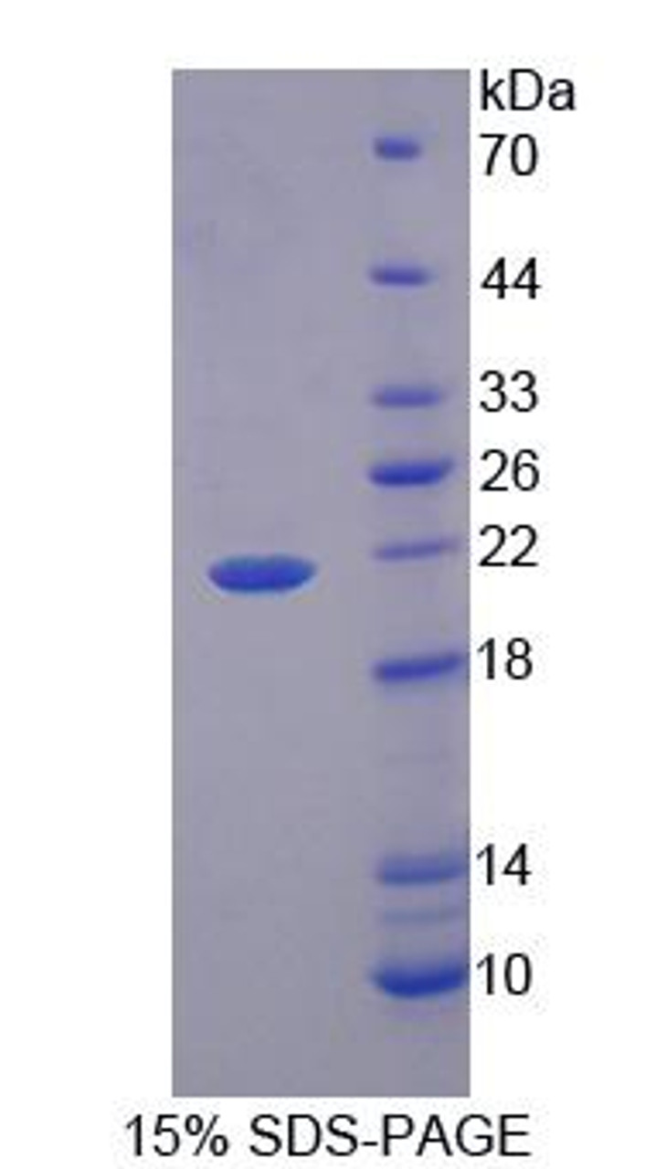 Mouse Recombinant Phospholipid Scramblase 3 (PLSCR3)