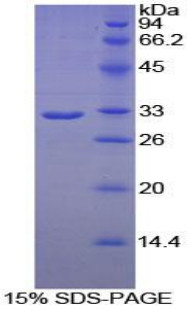 Human Recombinant Phospholipase A2 Receptor 1 (PLA2R1)