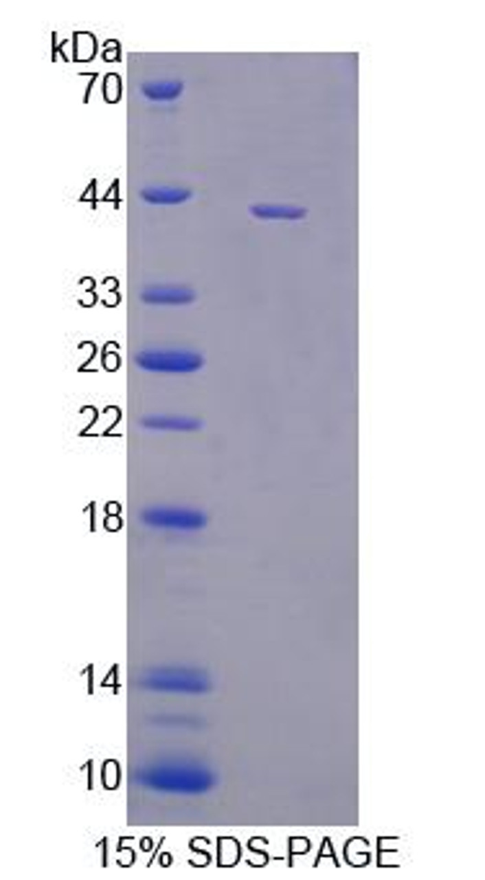 Human Recombinant Dynamin 3 (DNM3)