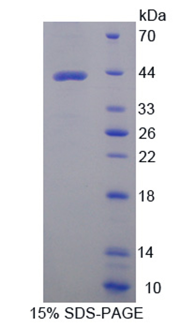 Human Recombinant Aspartate Aminotransferase 2 (AST2)