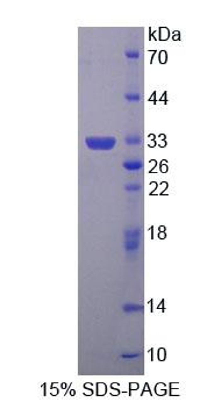 Human Recombinant 4-Aminobutyrate Aminotransferase (ABAT)