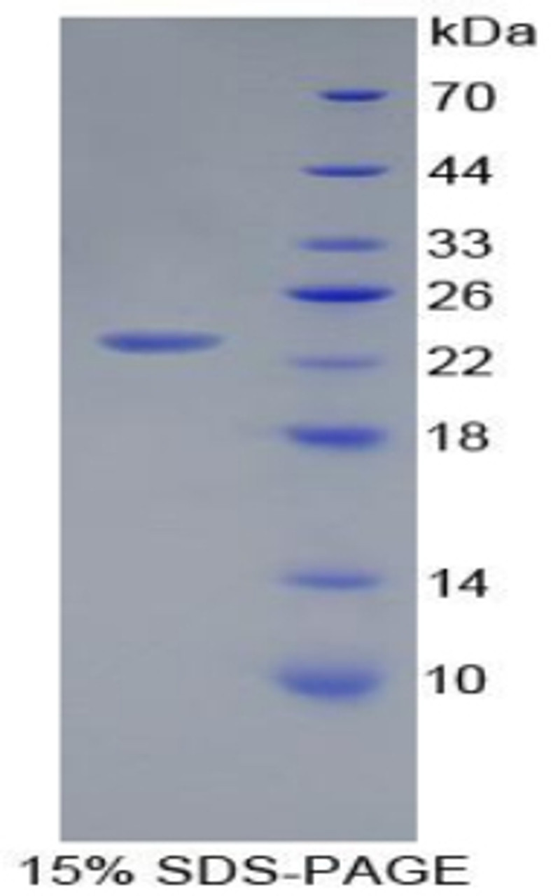 Rat Recombinant Peptidoglycan Recognition Protein 1 (PGLYRP1)