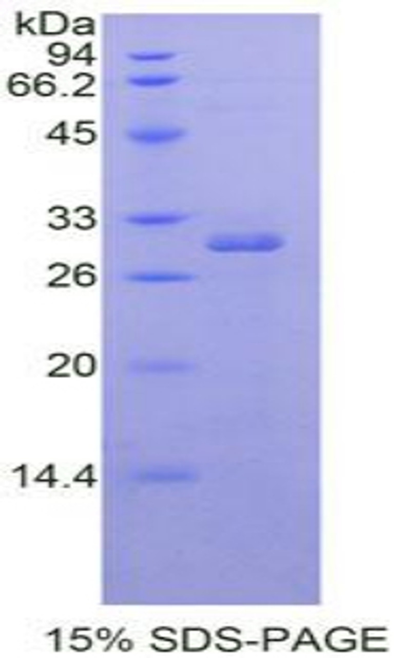 Human Recombinant RAR Related Orphan Receptor Alpha (RORa)