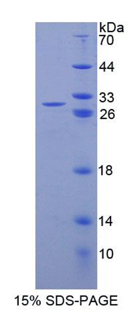 Mouse Recombinant Nuclear Receptor Subfamily 0, Group B, Member 1 (NR0B1)