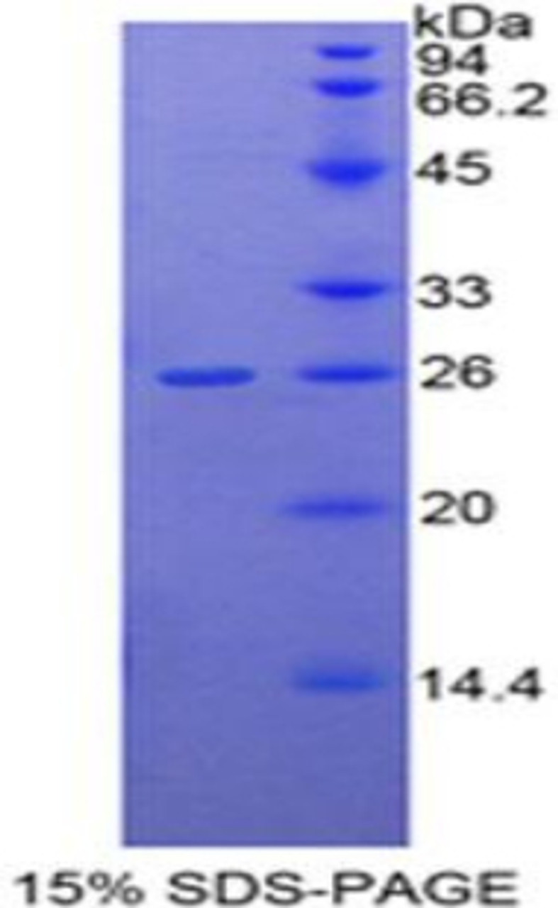 Human Recombinant Dimethylarginine Dimethylaminohydrolase 1 (DDAH1)