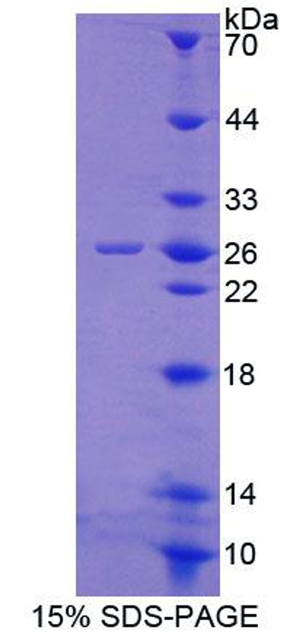 Rat Recombinant Glutathione Peroxidase 6, Olfactory (GPX6)