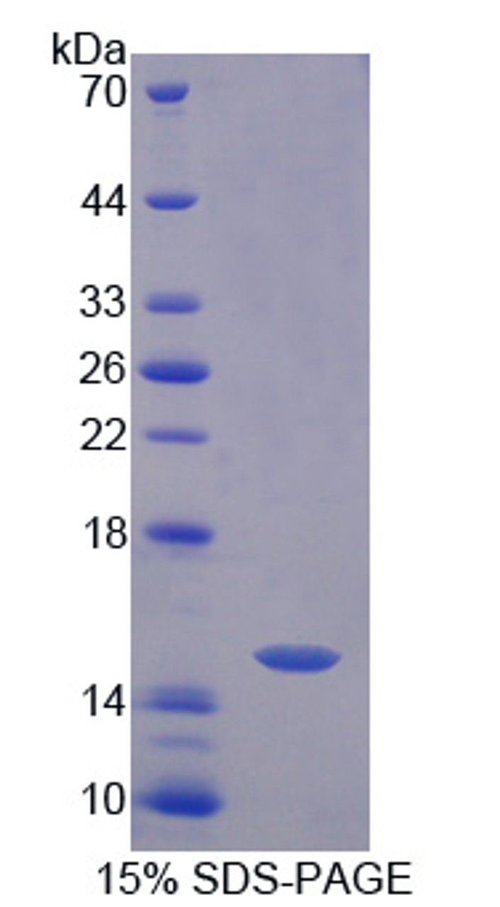 Human Recombinant CREB Regulated Transcription Coactivator 3 (CRTC3)