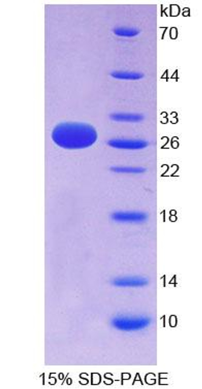 Human Recombinant Ephrin A3 (EFNA3)