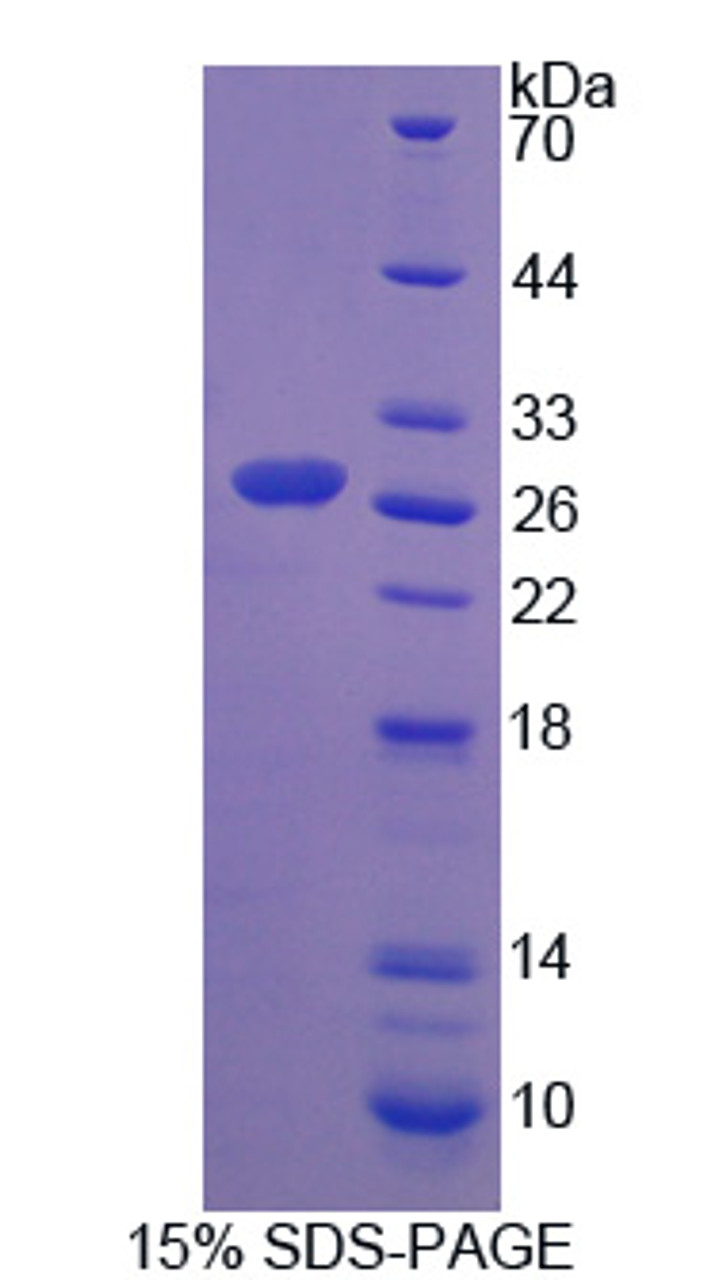 Human Recombinant Chymotrypsinogen B1 (CTRB1)