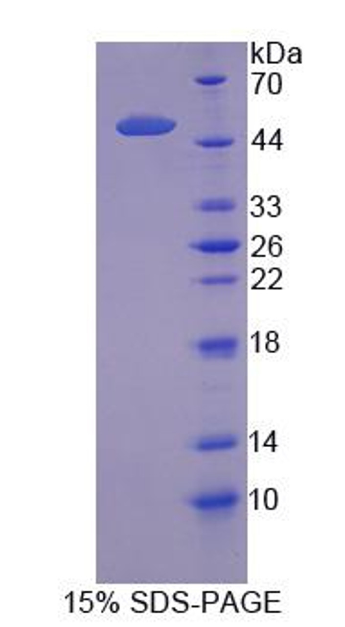 Human Recombinant Solute Carrier Family 1, Member 5 (SLC1A5)