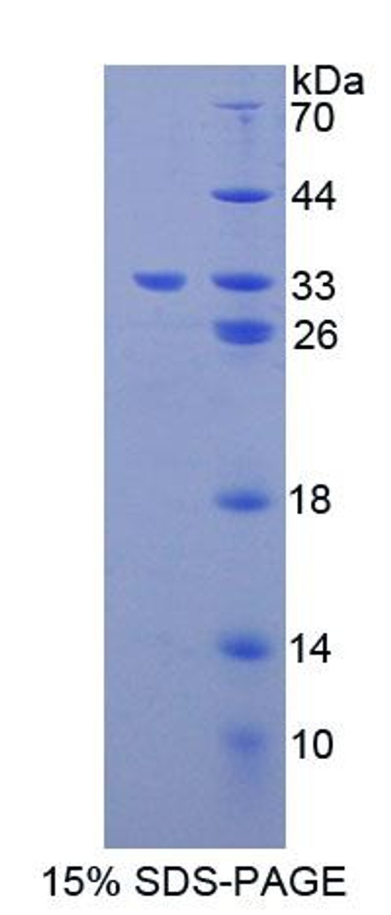 Mouse Recombinant Gibbon Ape Leukemia Virus Receptor 1 (GLVR1)