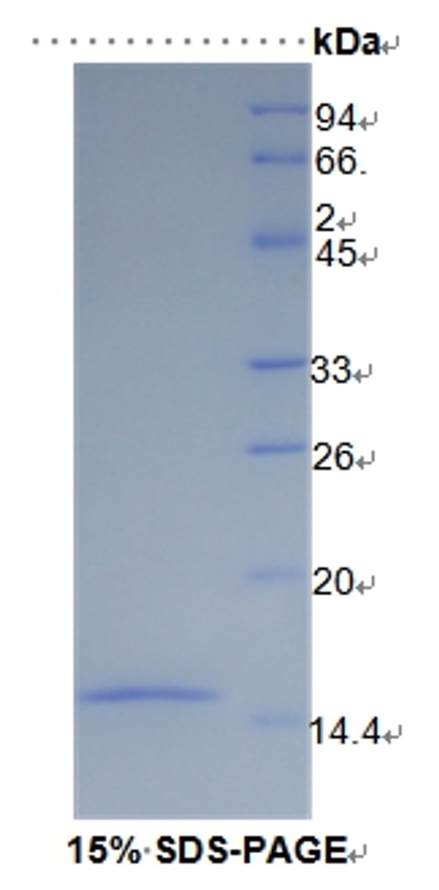 Human Recombinant Solute Carrier Family 30 Member 8 (SLC30A8)