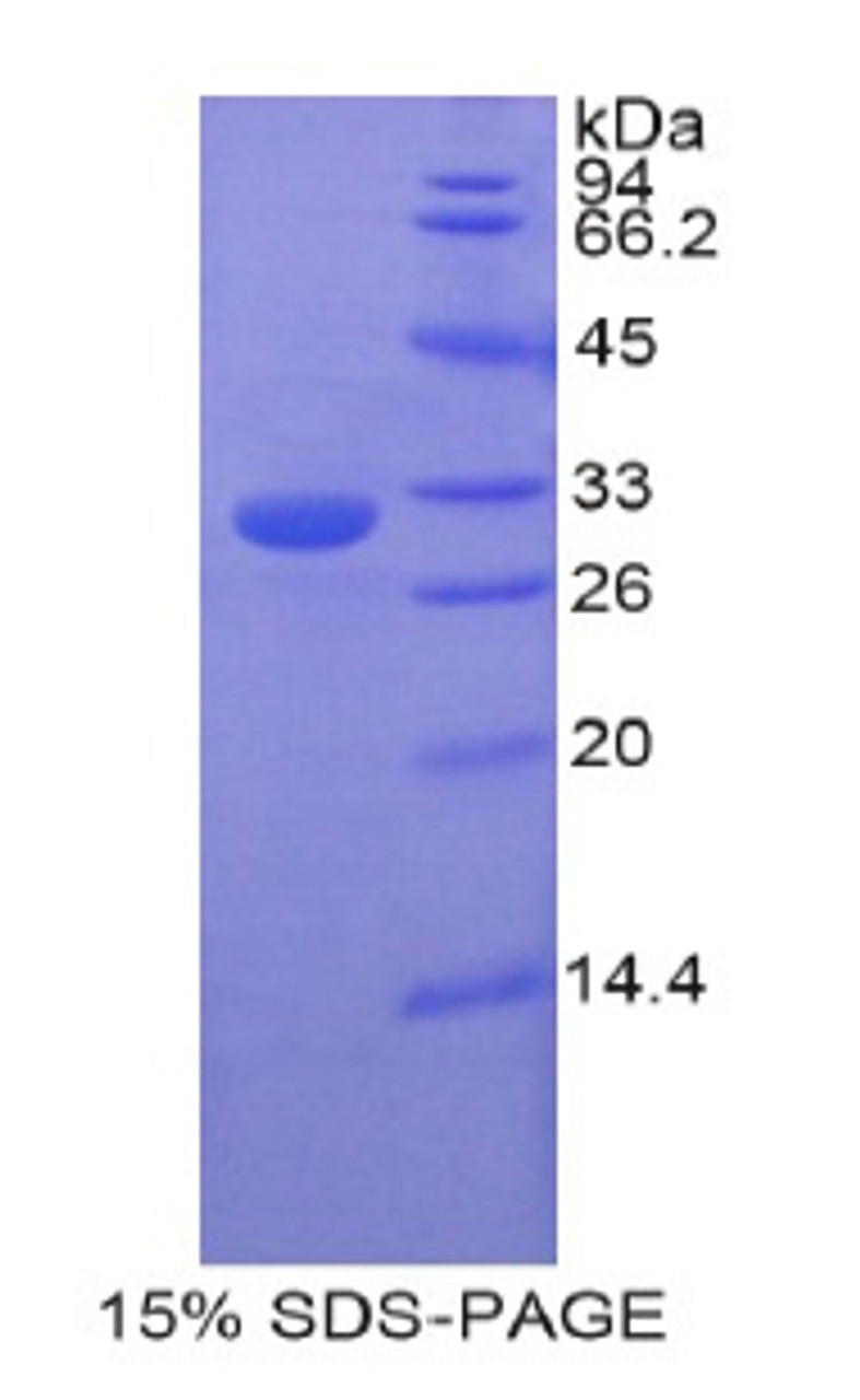 Rat Recombinant Electron Transfer Flavoprotein Alpha Polypeptide (ETFa)