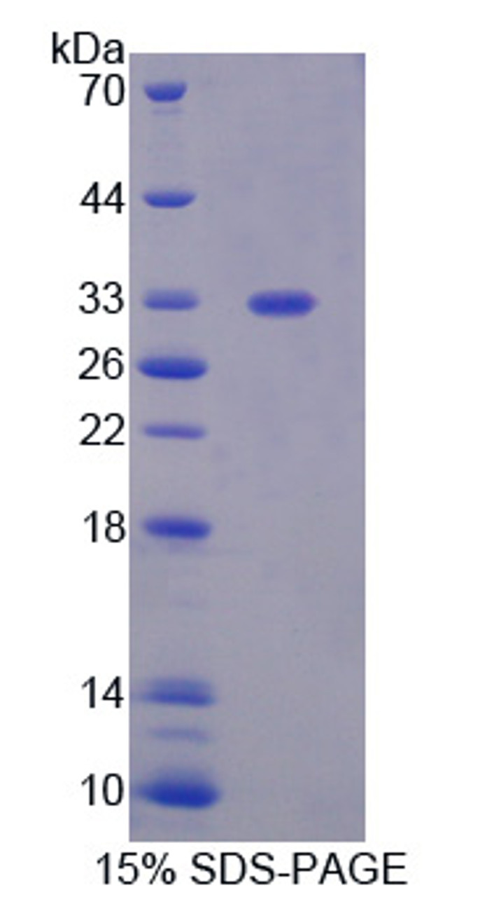 Human Recombinant Phosphoglycerate Mutase 1, Brain (PGAM1)