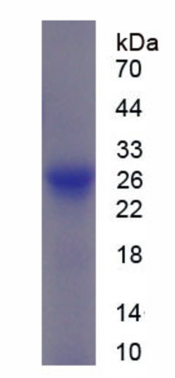 Cattle Recombinant Alpha-1-B-Glycoprotein (a1BG)