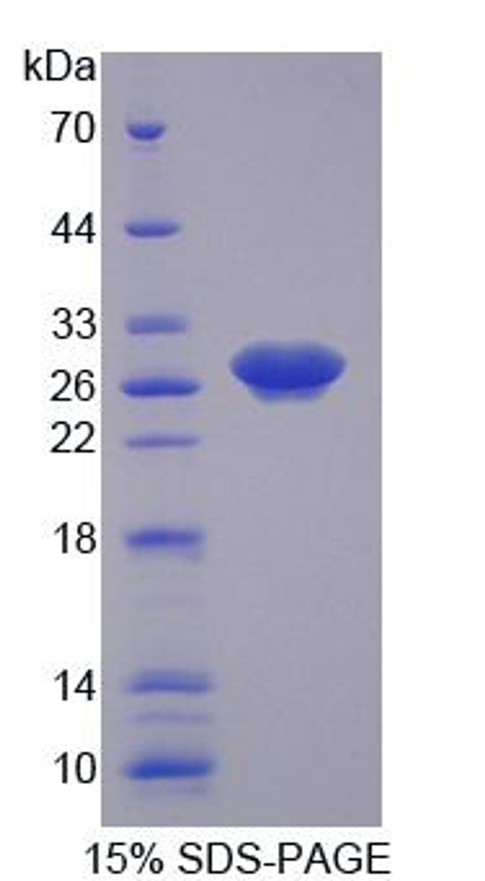 Human Recombinant Cyclin Dependent Kinase 16 (CDK16)