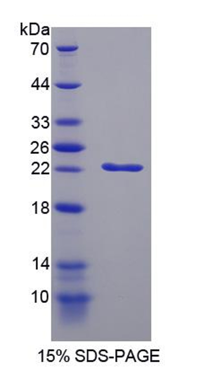 Rat Recombinant Cyclin Dependent Kinase Inhibitor 1A (CDKN1A)