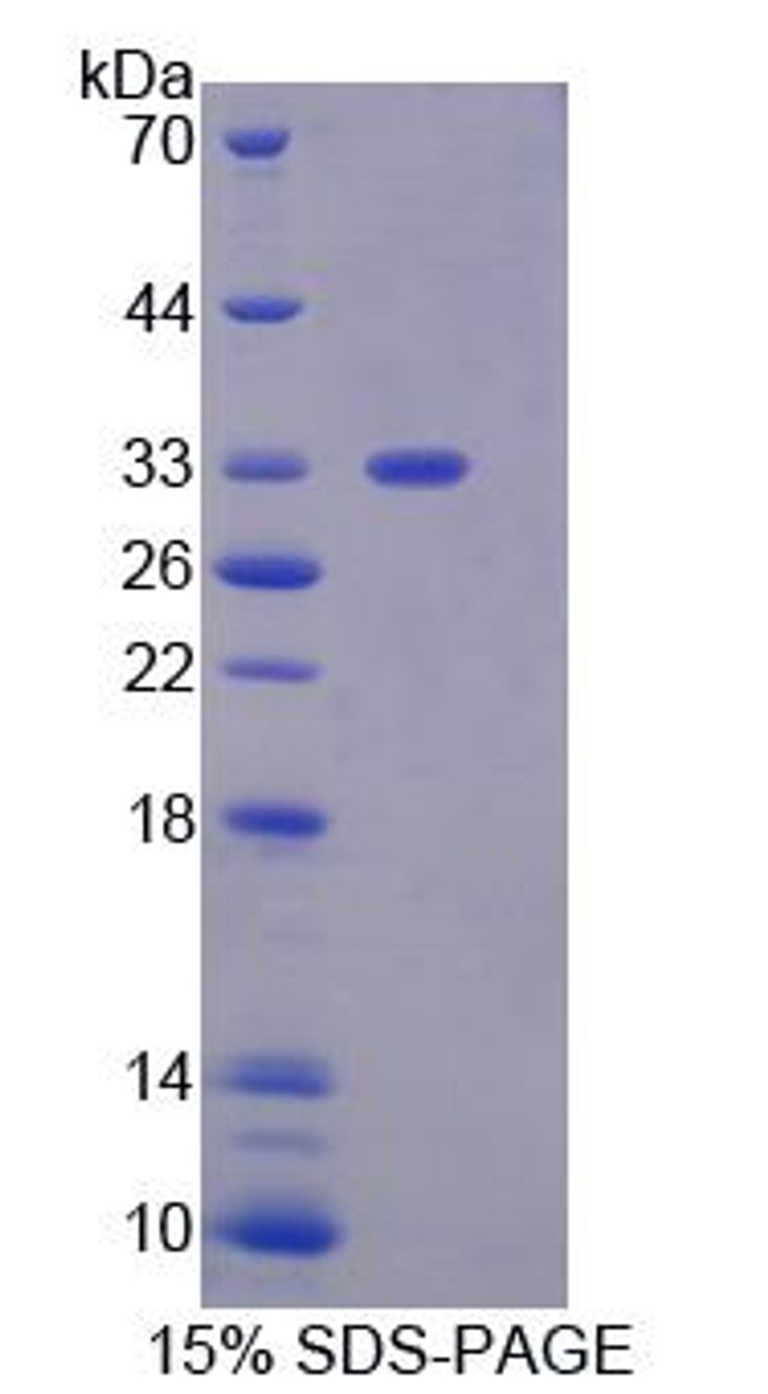 Mouse Recombinant Guanylate Binding Protein 2, Interferon Inducible (GBP2)