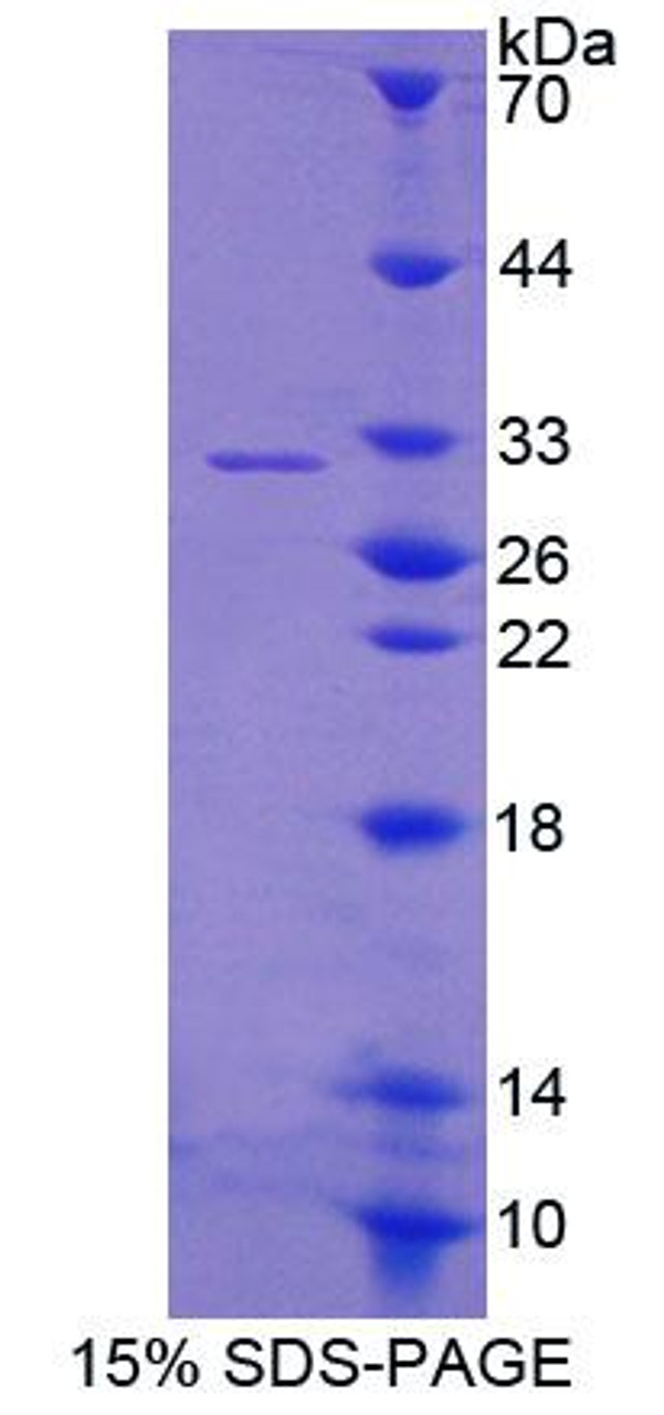 Rat Recombinant Guanylate Binding Protein 2, Interferon Inducible (GBP2)