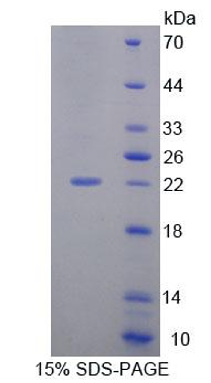 Human Recombinant Cell Division Cycle Protein 16 (CDC16)