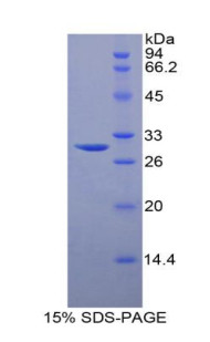 Human Recombinant Sphingosine Kinase 1 (SPHK1)