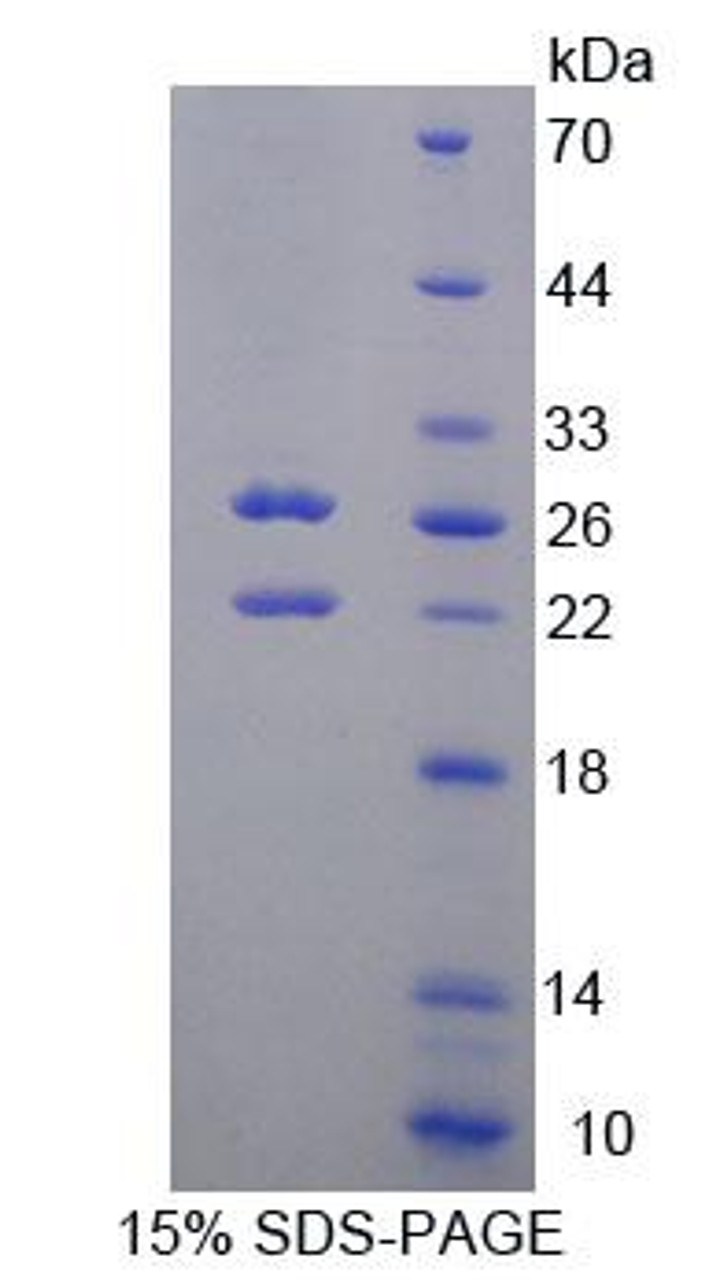 Human Recombinant Sphingosine Kinase 2 (SPHK2)