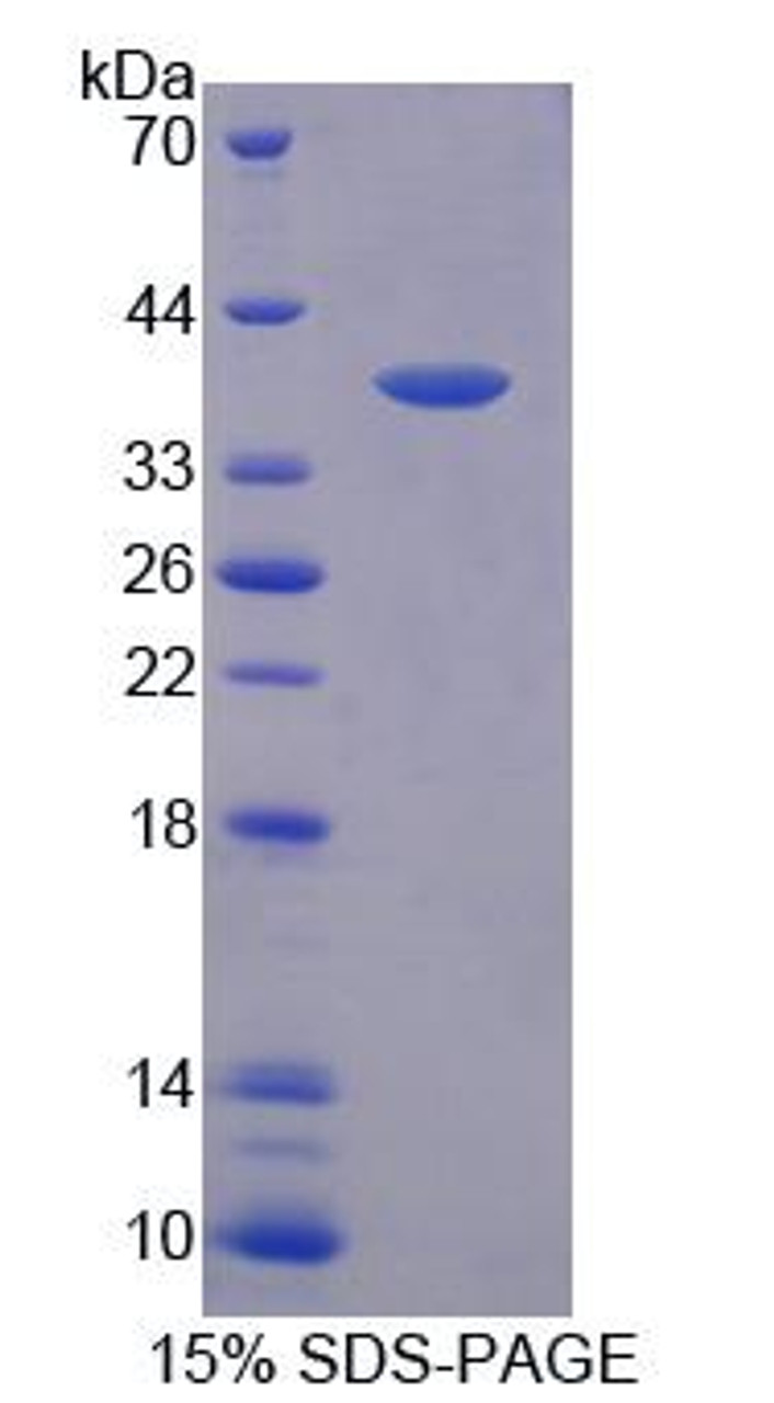 Human Recombinant Peroxisomal Biogenesis Factor 19 (PEX19)