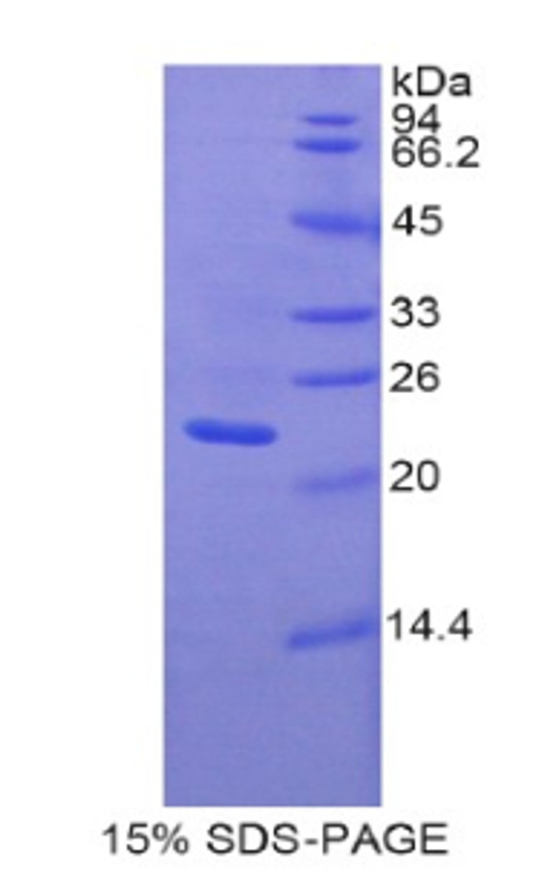 Rat Recombinant Pannexin 1 (PANX1)