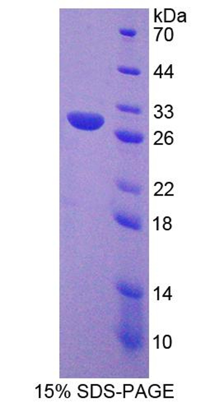 Mouse Recombinant Diacylglycerol Kinase Gamma (DGKg)