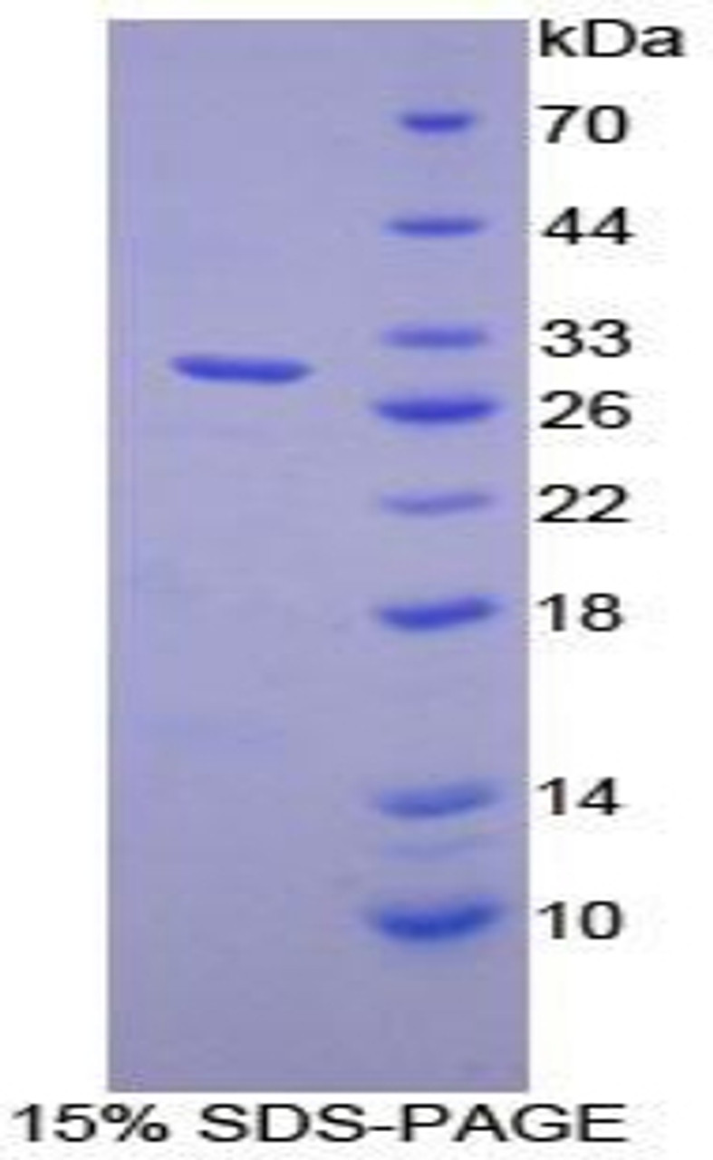 Human Recombinant Diacylglycerol Kinase Zeta (DGKz)