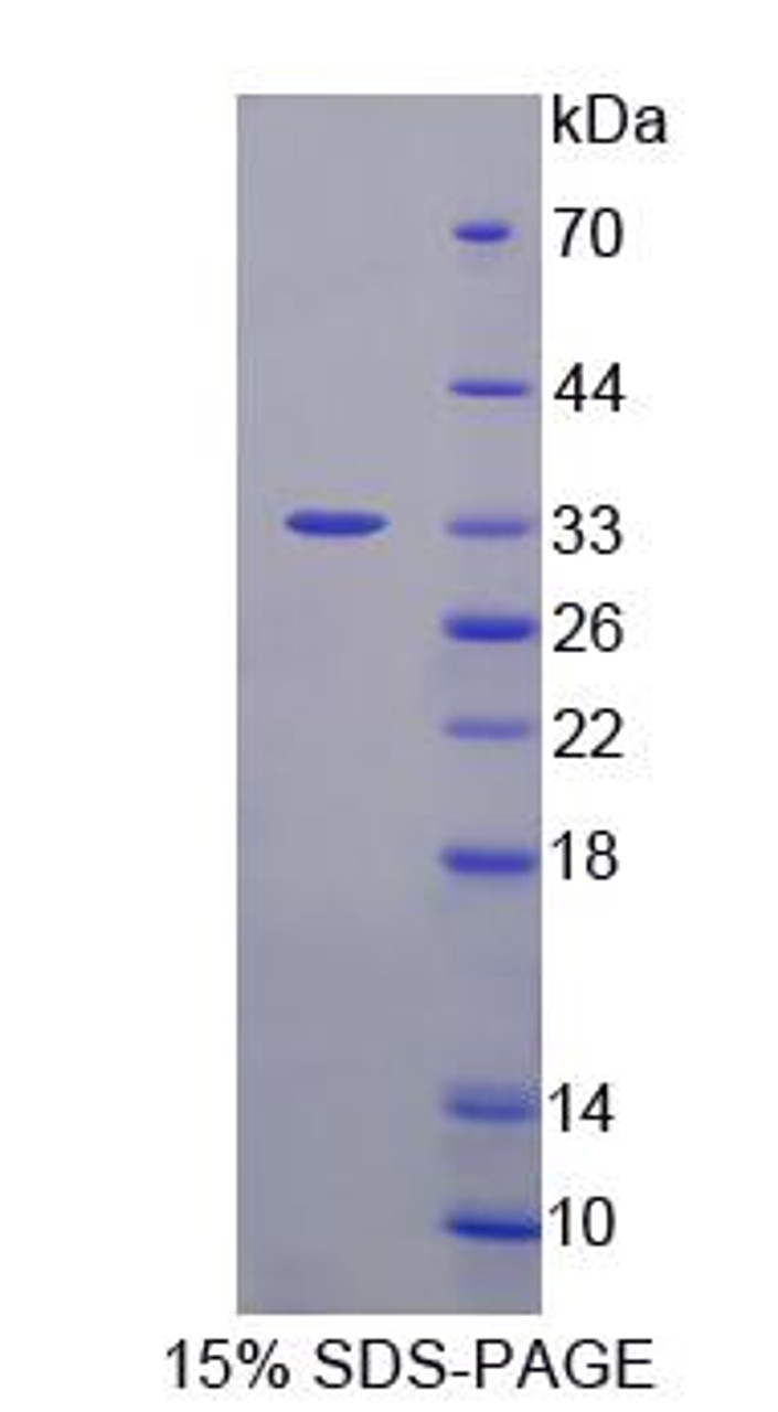 Mouse Recombinant Diacylglycerol Kinase Zeta (DGKz)