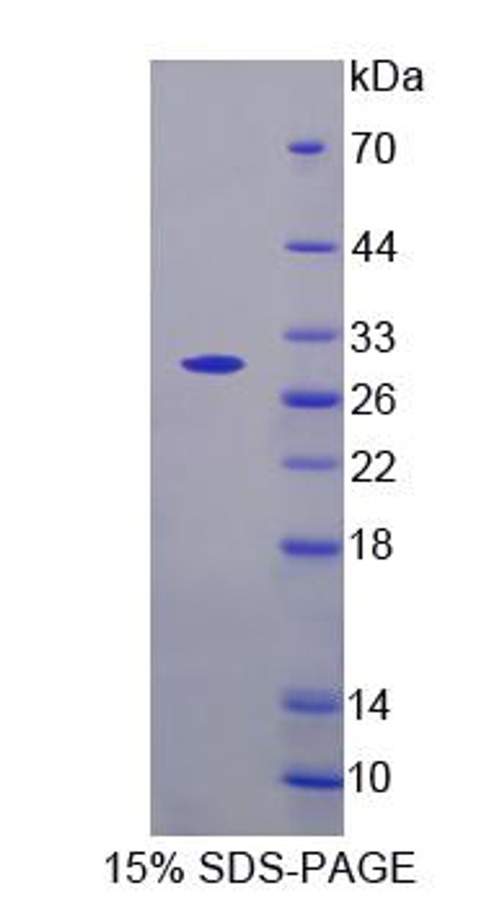 Rat Recombinant Glycine Receptor Alpha 2 (GLRa2)