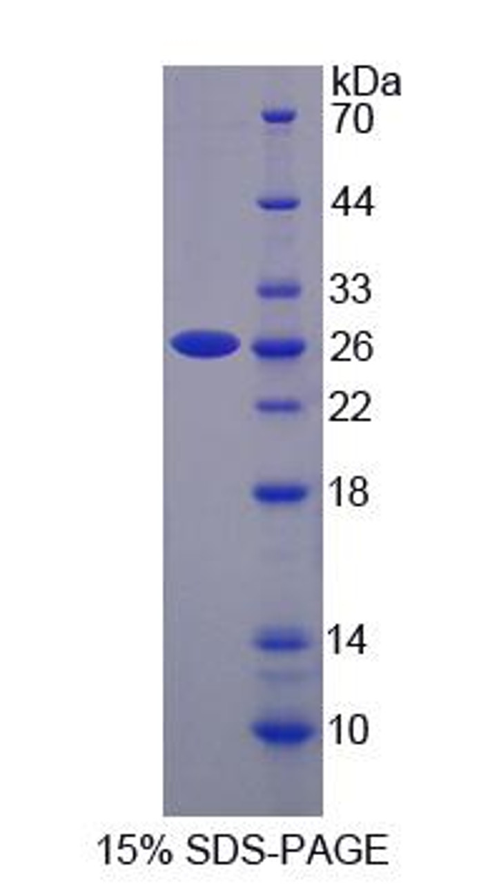 Human Recombinant Sorting Nexin 17 (SNX17)