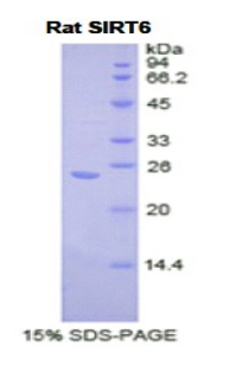 Rat Recombinant Sirtuin 6 (SIRT6)