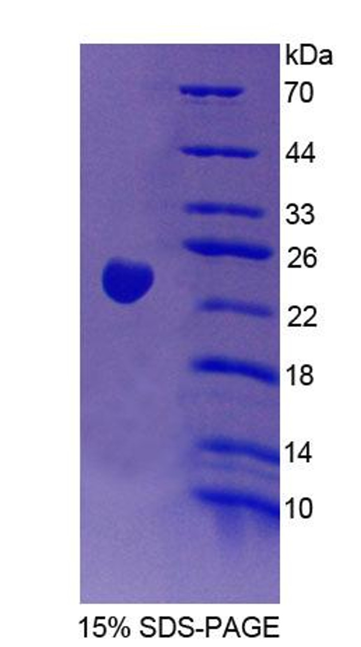 Human Recombinant Vav 3 Oncogene (VAV3)